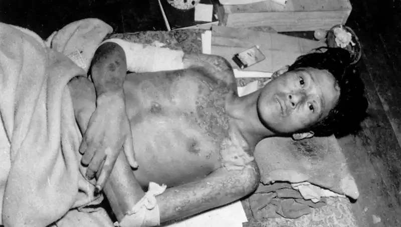 80 Yıl Sonra Nagasaki'den Tüm Dünyaya Nükleer Felaket Uyarısı