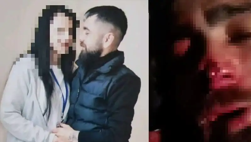 Eski Sevgiliye Şok Eden İşkence: Abisi Tarafından Kulağı ve Burnu Koparıldı